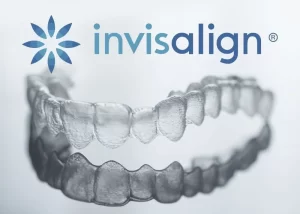 Alinhador Invisível Invisalign